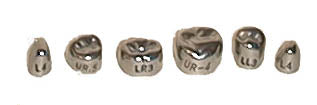 1st. Permanent Stainless Steel Crowns Refills Box of 5 - Davis Dental ...